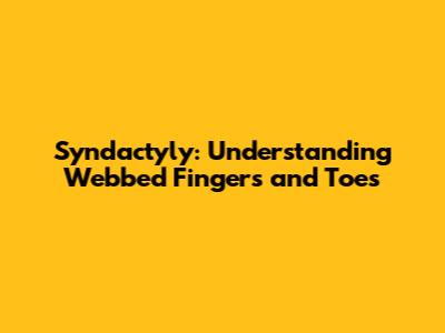 Syndactyly: Understanding Webbed Fingers and Toes